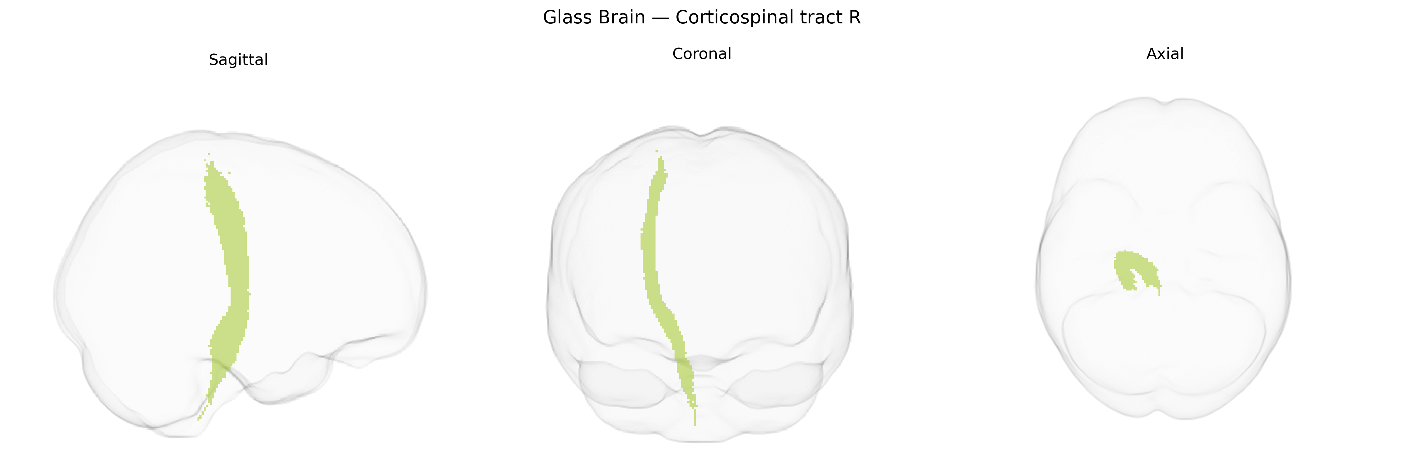 Triplanar Ghost Brain