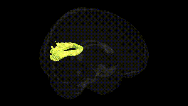 Full Brain Black