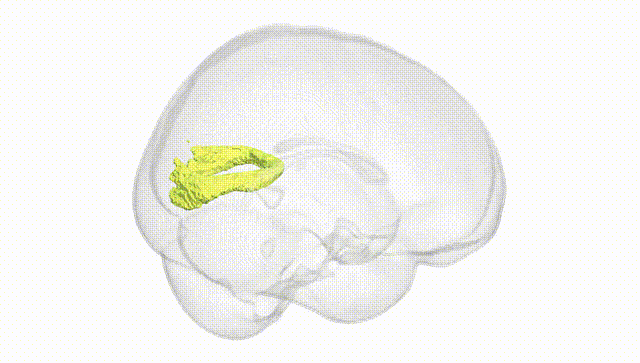 Full Brain White