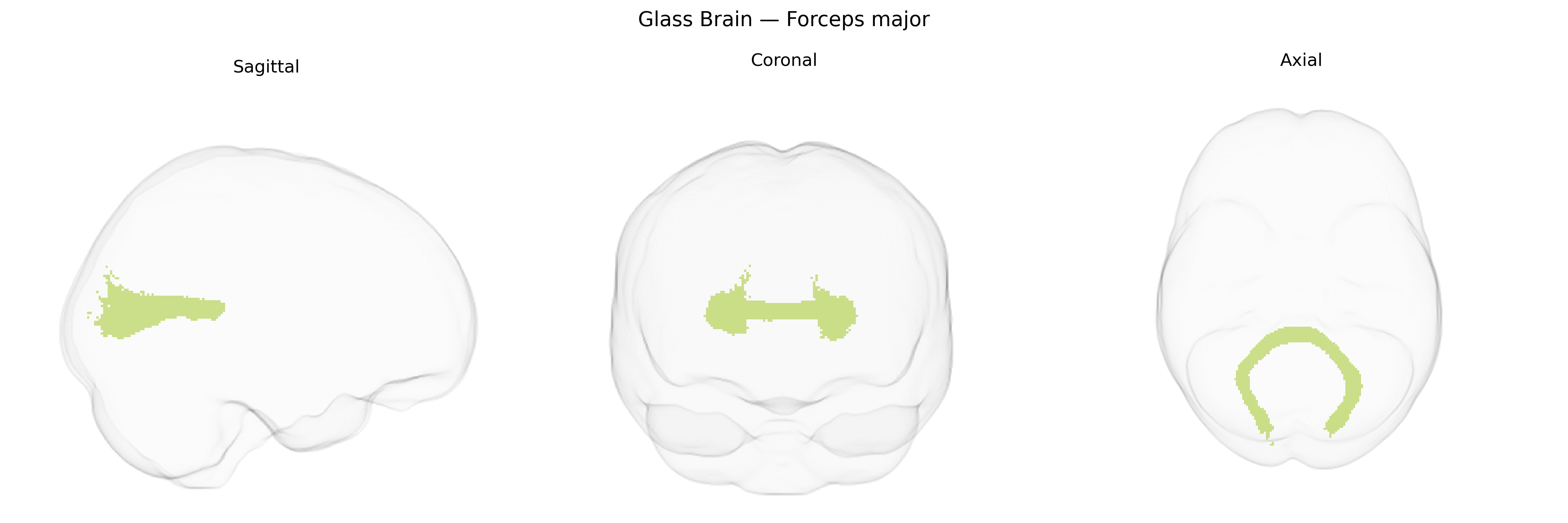 Triplanar Ghost Brain