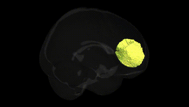 Full Brain Black