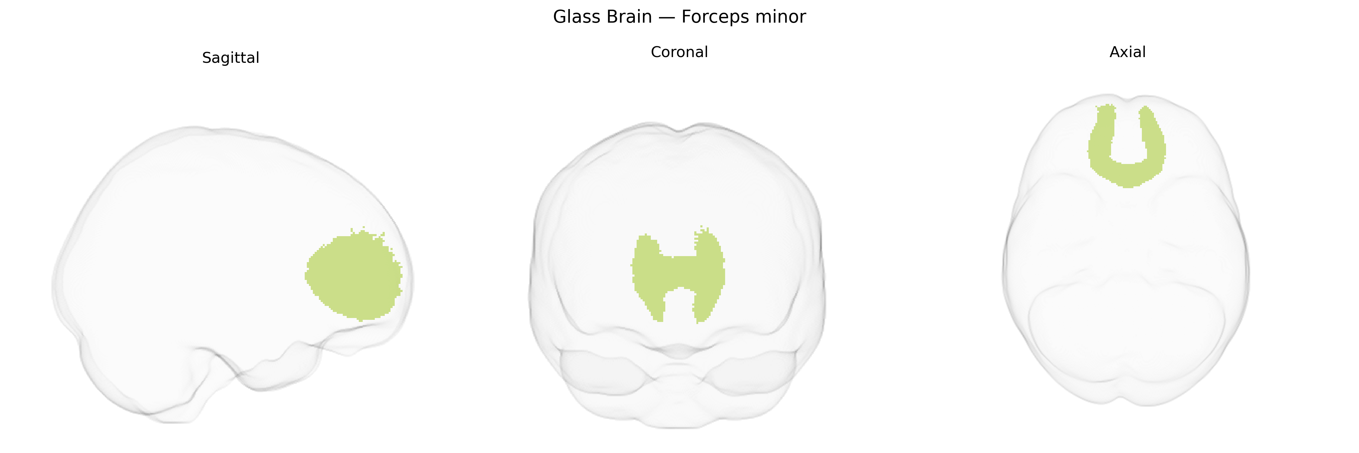Triplanar Ghost Brain