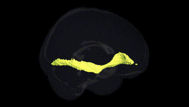 Full Brain Black