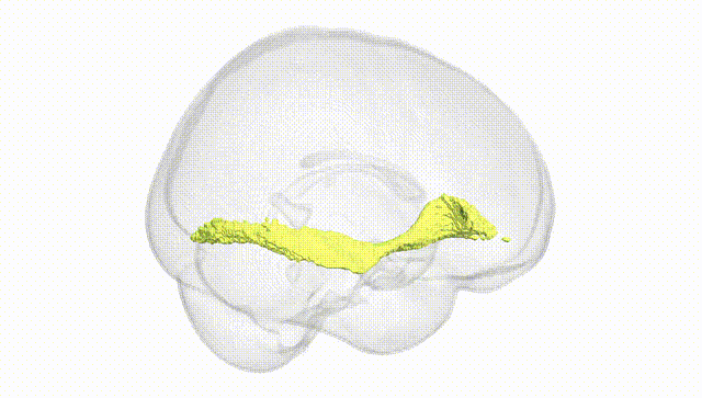 Full Brain White