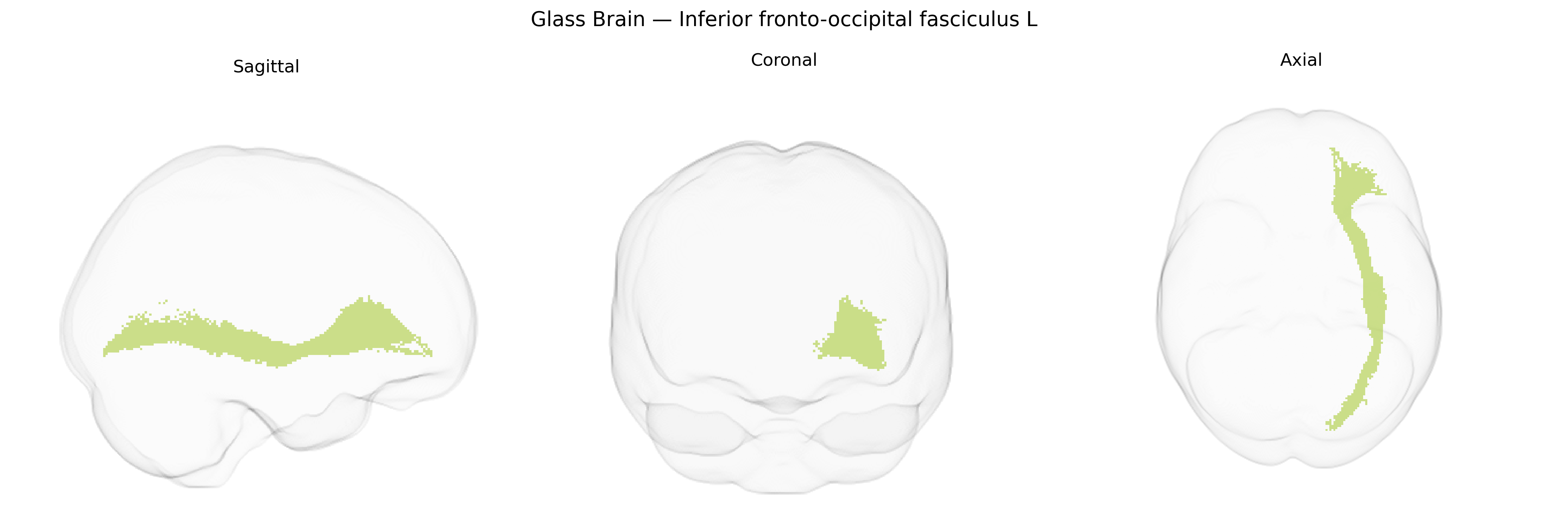 Triplanar Ghost Brain