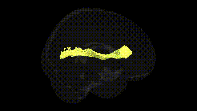 Full Brain Black