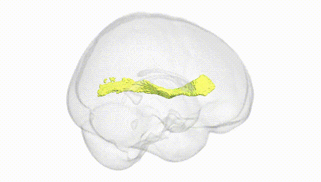 Full Brain White