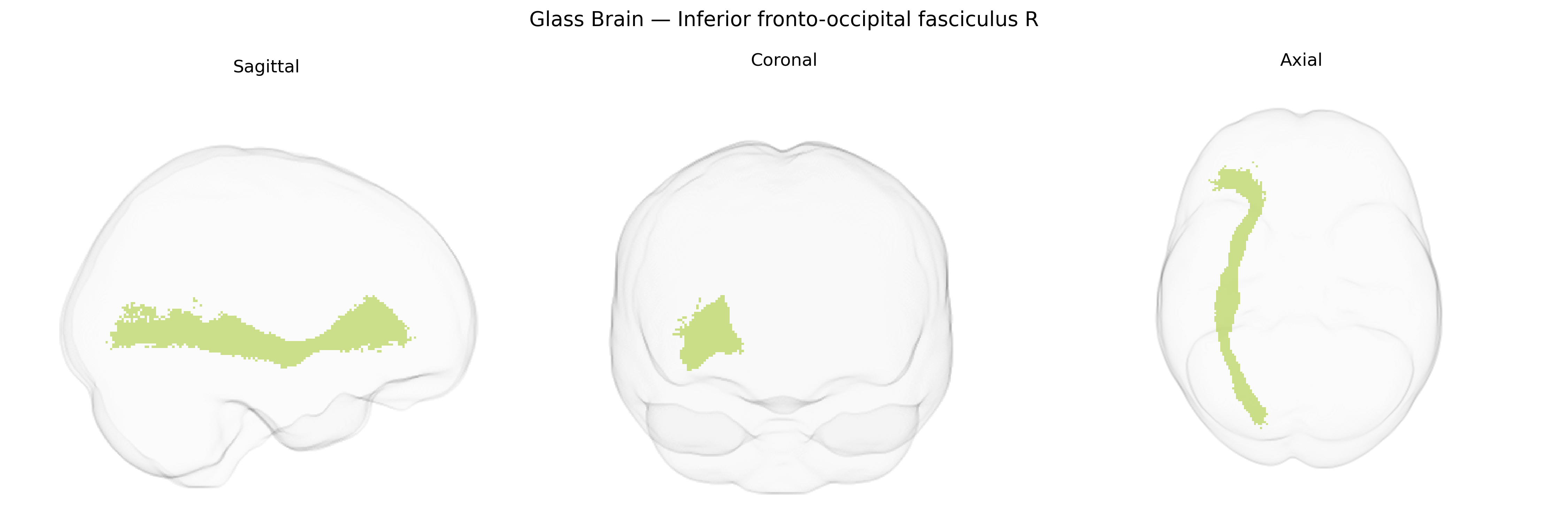 Triplanar Ghost Brain