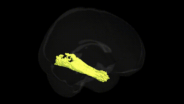 Full Brain Black