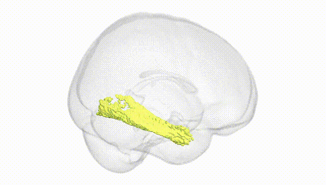 Full Brain White