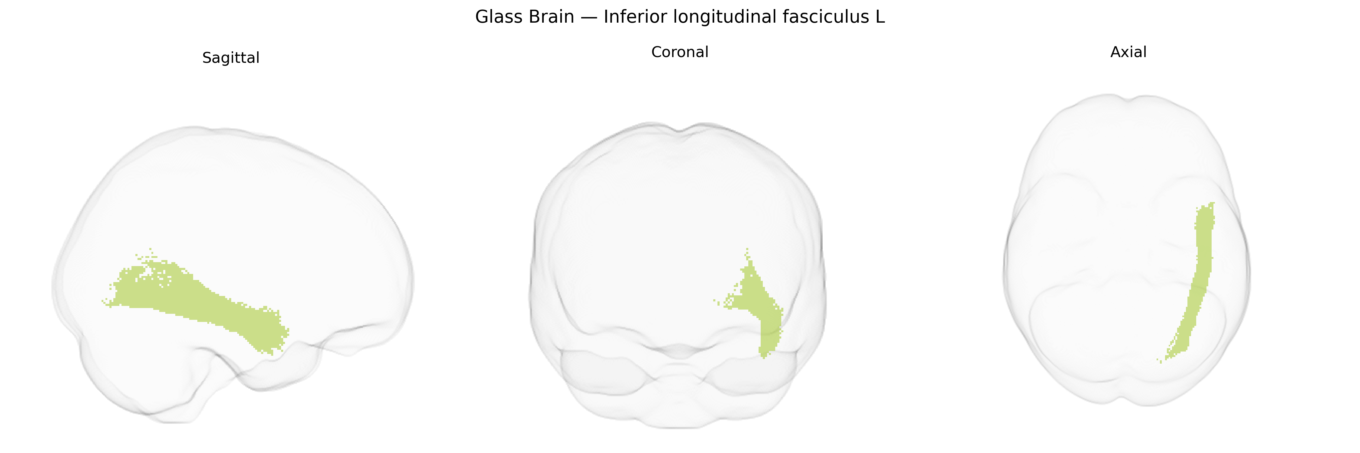Triplanar Ghost Brain
