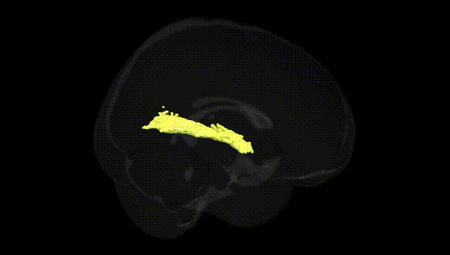 Full Brain Black