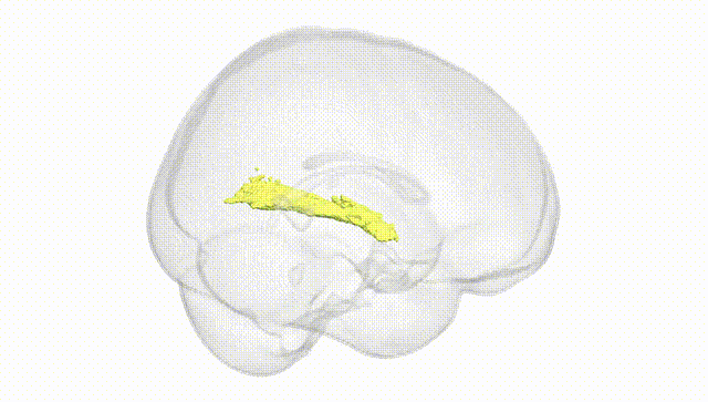 Full Brain White