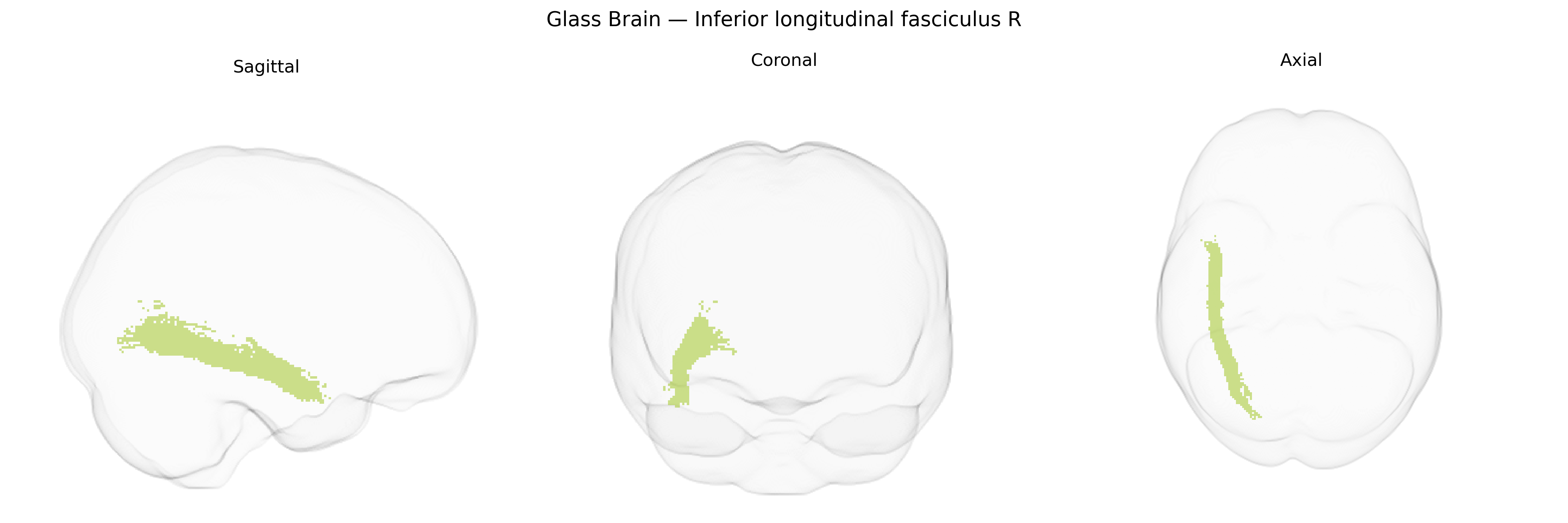 Triplanar Ghost Brain