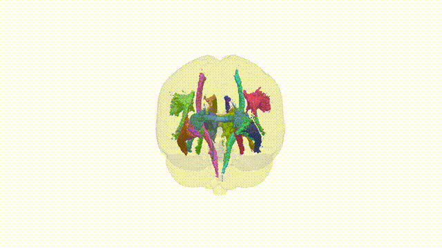 Rotating Brain
