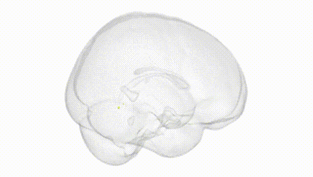Full Brain White