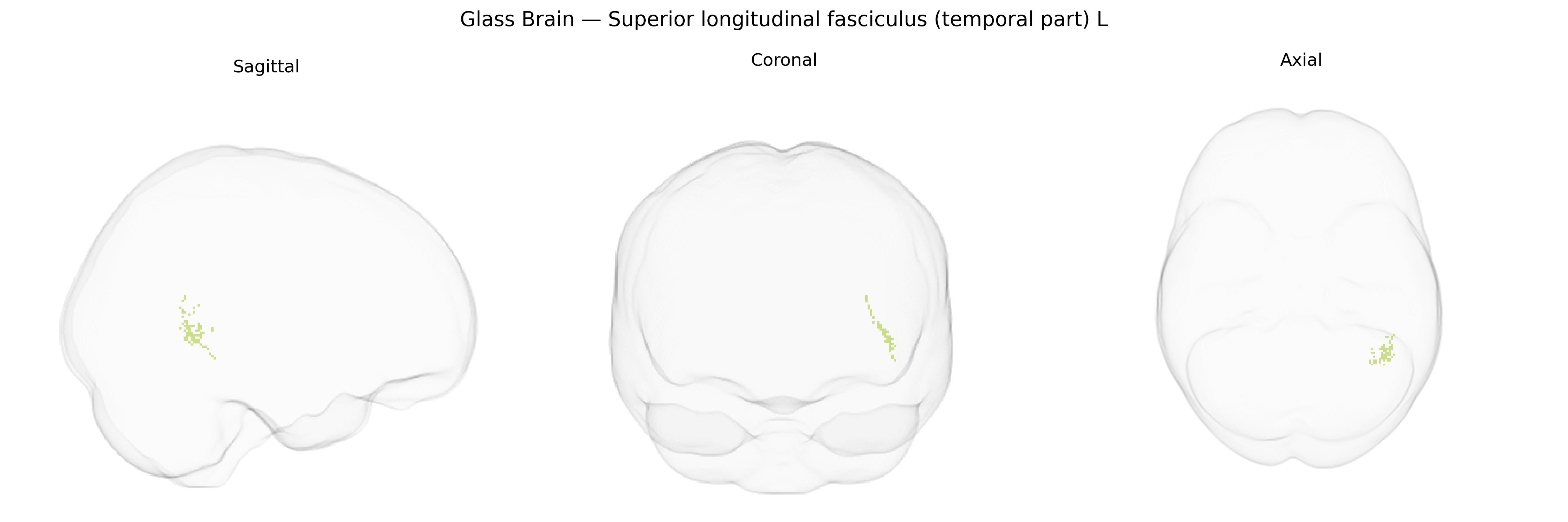 Triplanar Ghost Brain