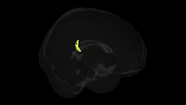 Full Brain Black