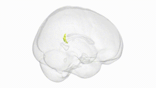 Full Brain White