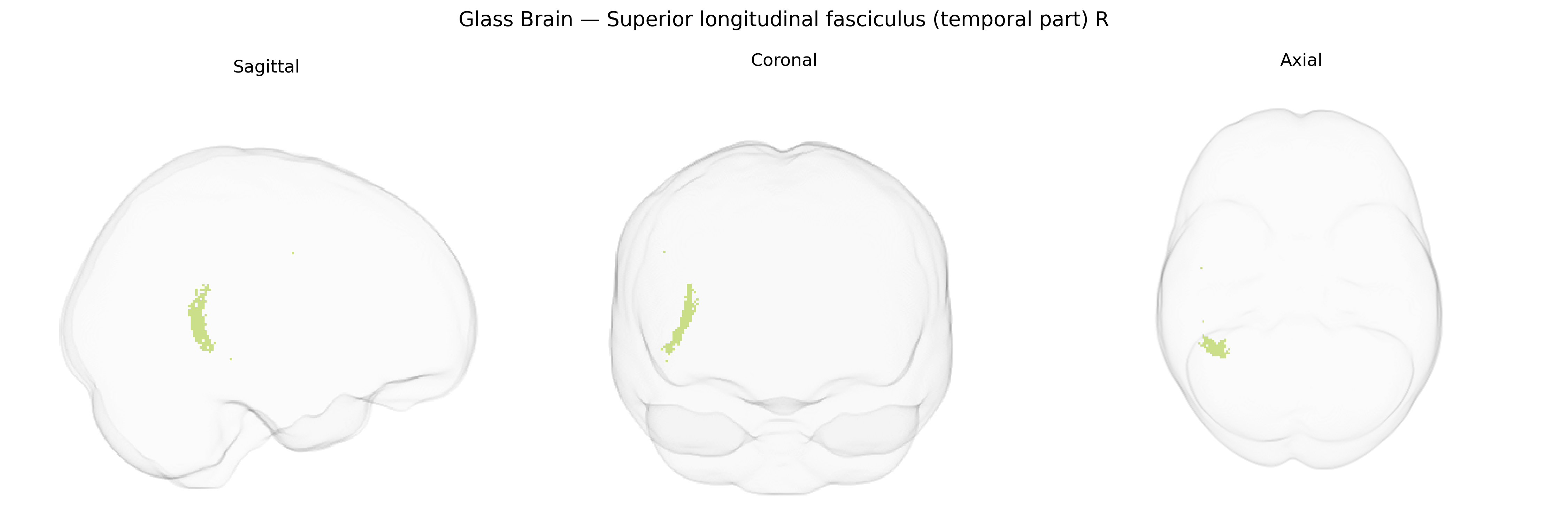 Triplanar Ghost Brain