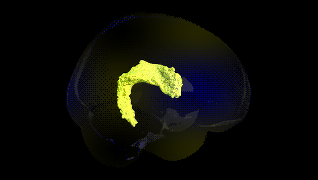 Full Brain Black