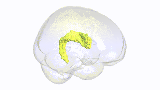 Full Brain White