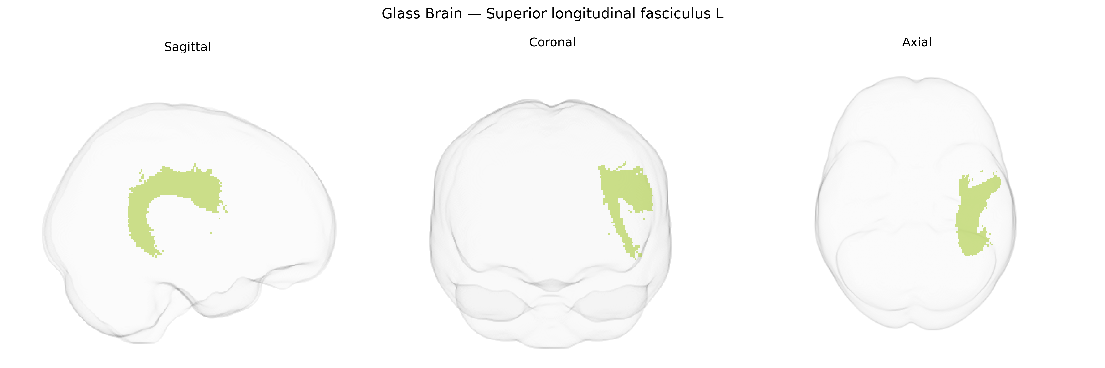 Triplanar Ghost Brain
