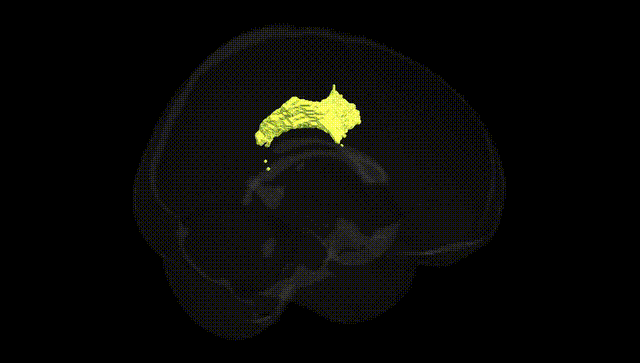 Full Brain Black