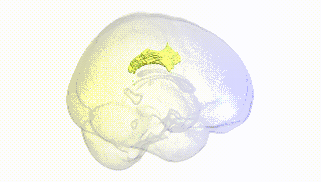 Full Brain White