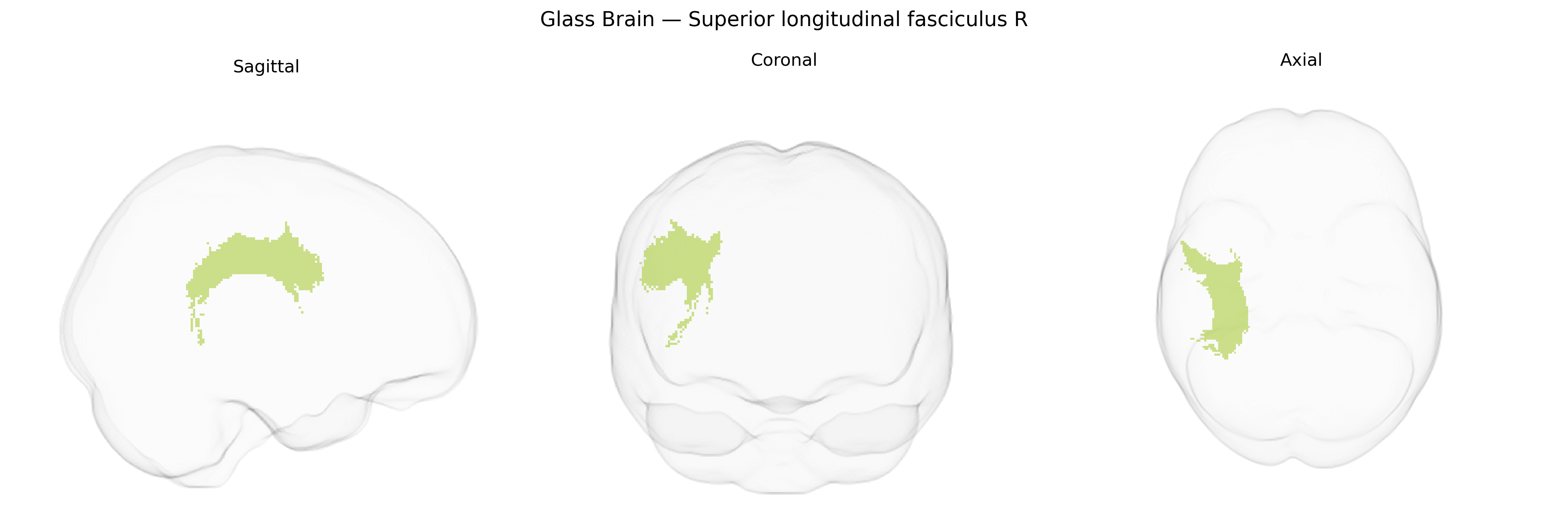 Triplanar Ghost Brain