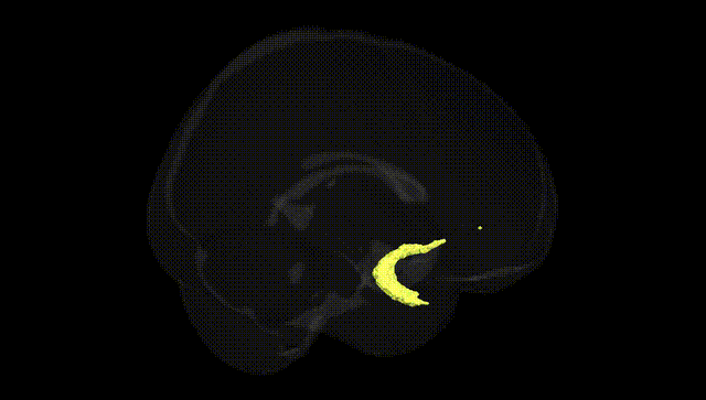Full Brain Black