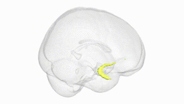 Full Brain White