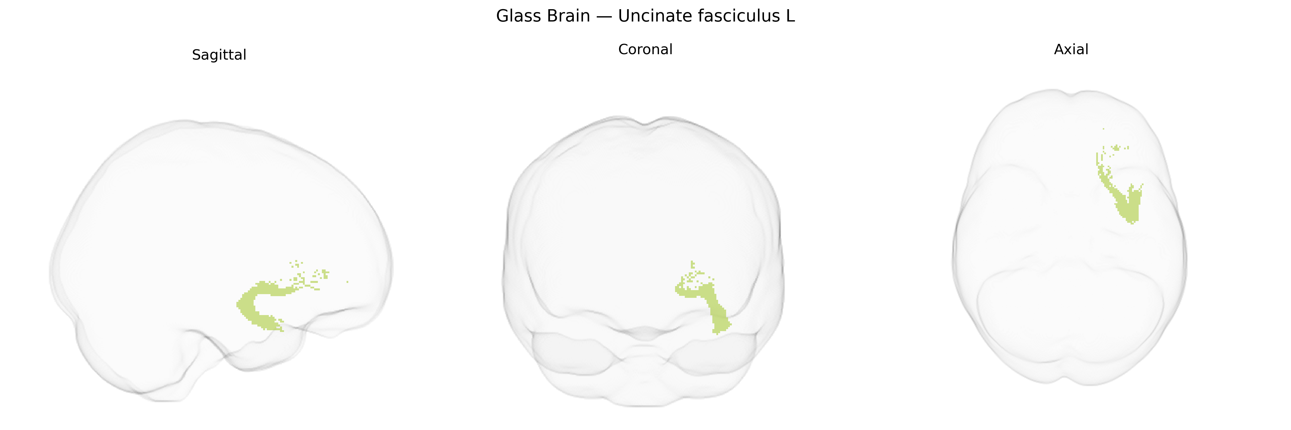 Triplanar Ghost Brain