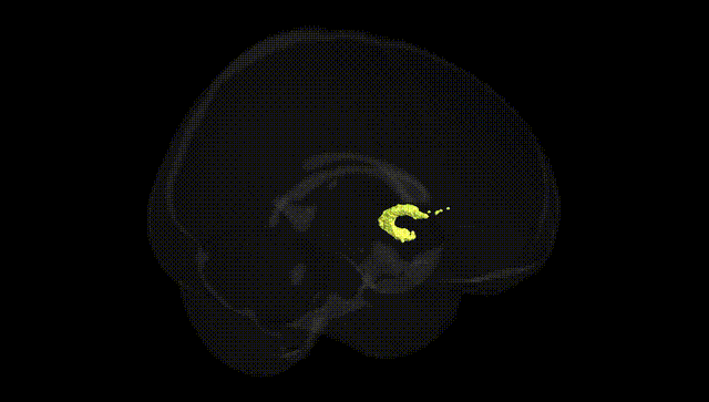Full Brain Black