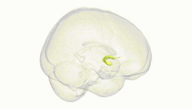 Full Brain White