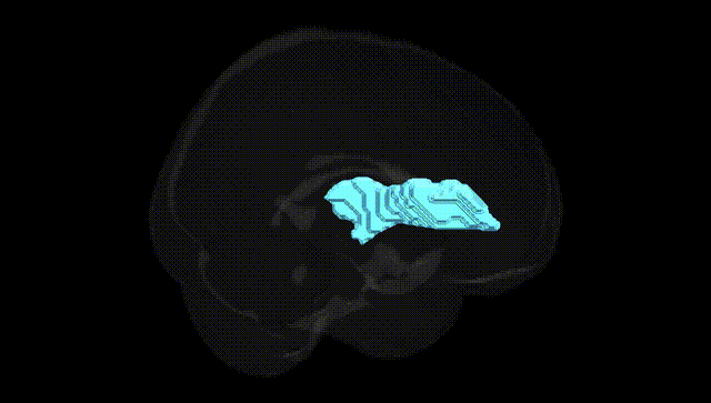 Full Brain Black
