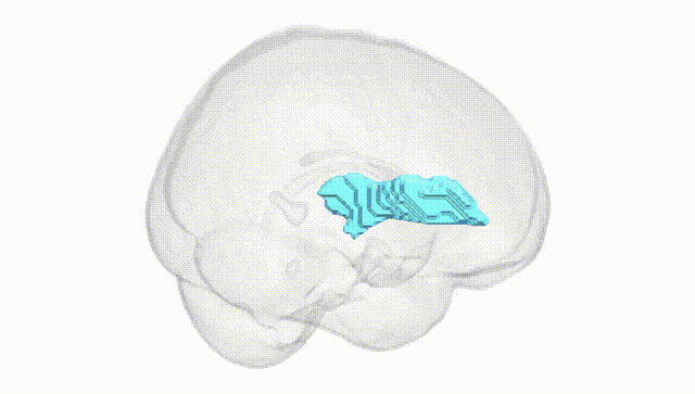 Full Brain White