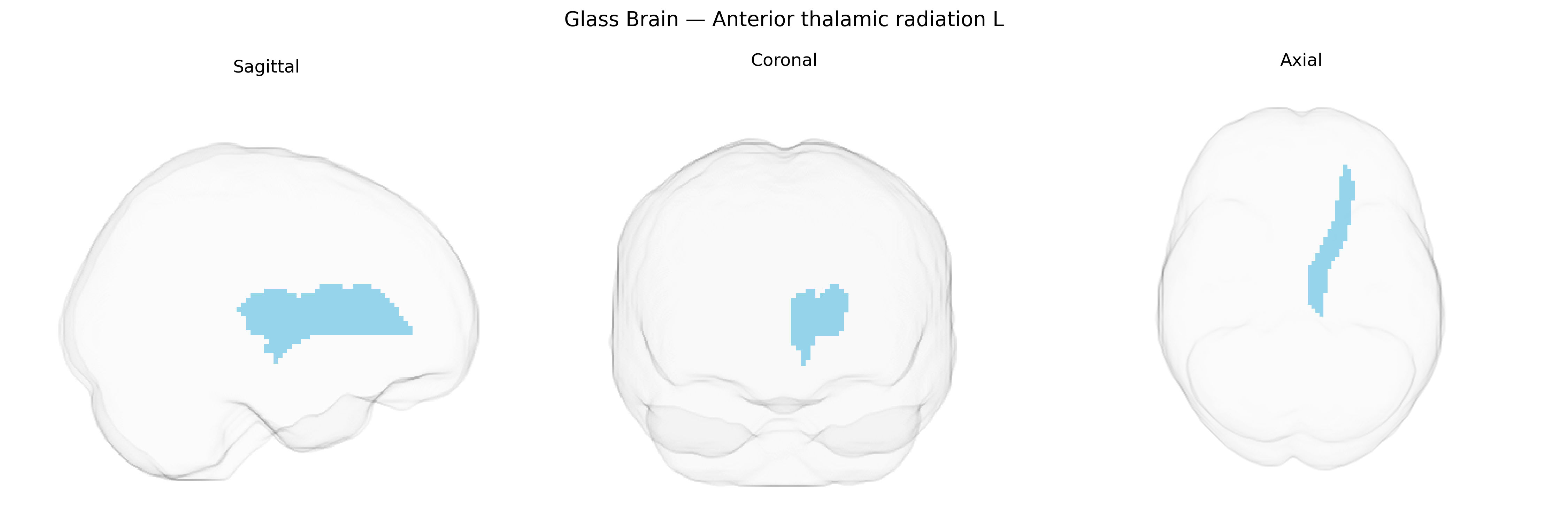 Triplanar Ghost Brain