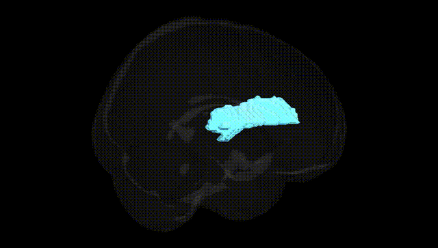 Full Brain Black