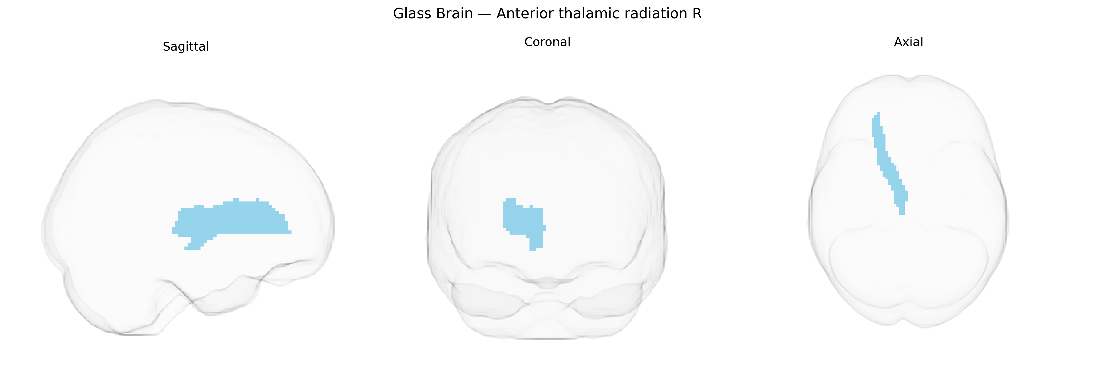 Triplanar Ghost Brain