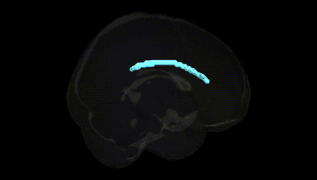 Full Brain Black