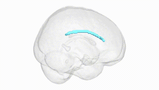 Full Brain White