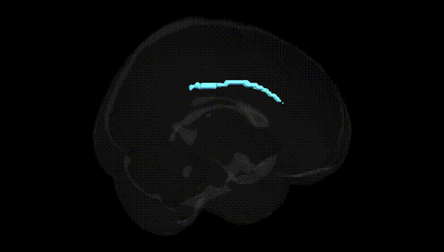 Full Brain Black