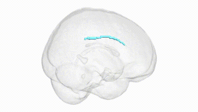 Full Brain White