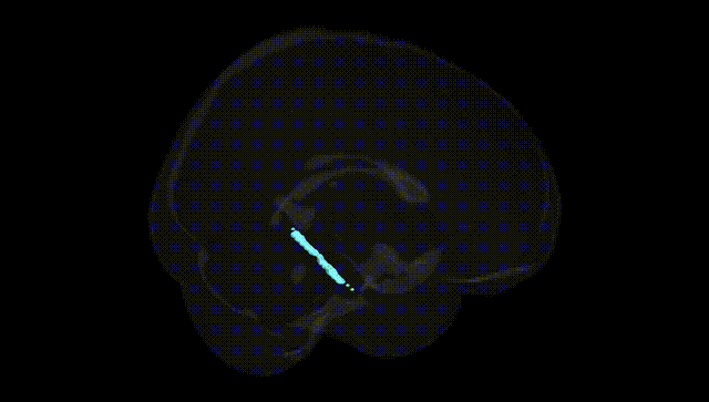 Full Brain Black