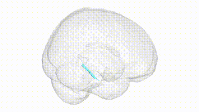 Full Brain White