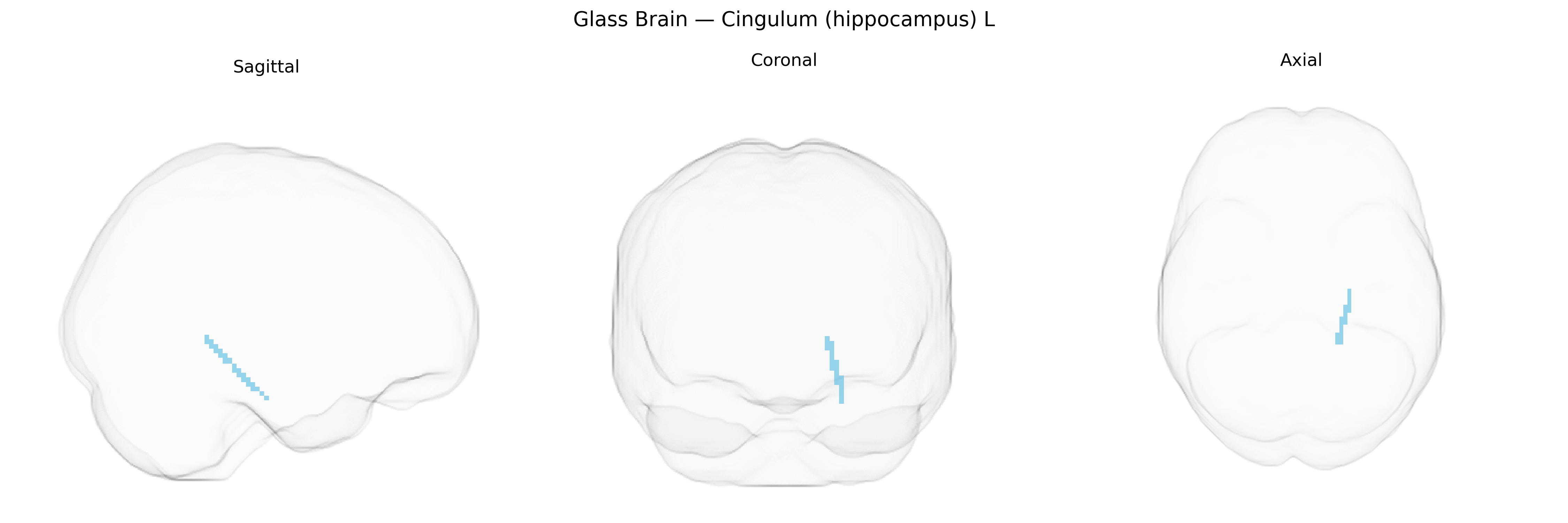 Triplanar Ghost Brain