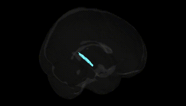 Full Brain Black