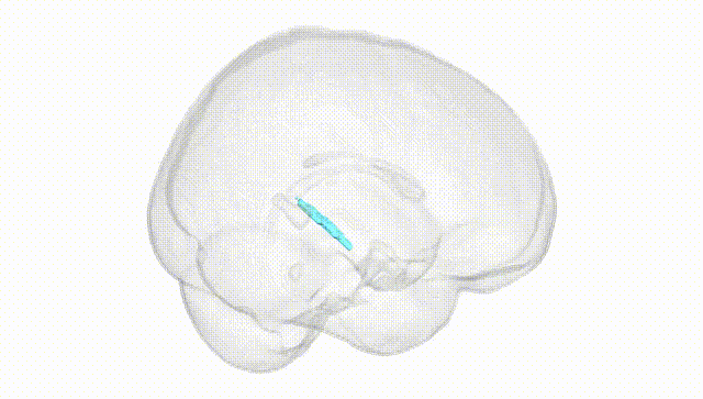 Full Brain White