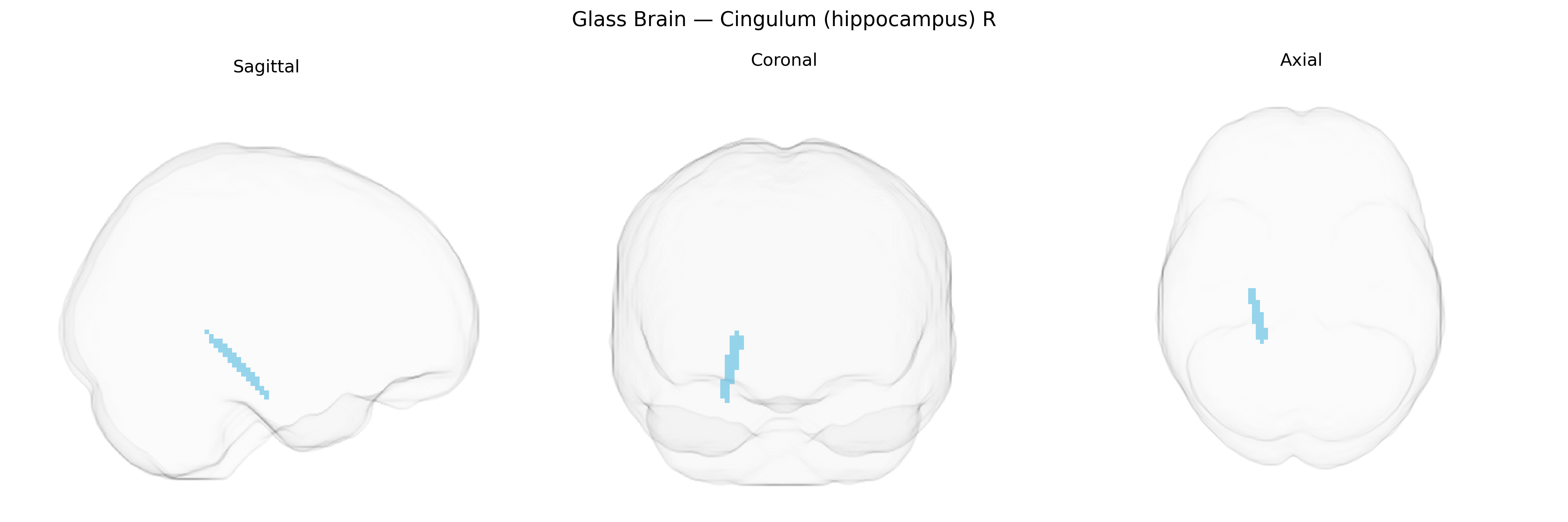 Triplanar Ghost Brain